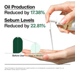 Graph showing oil production reduced by 17.38% and sebum levels reduced by 22.81% after 4 weeks of using Heartleaf Glow Cleansing Oil.